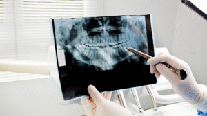 Dentist examining dental X-ray with tools.